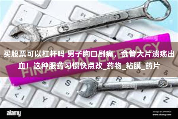 买股票可以杠杆吗 男子胸口剧痛，食管大片溃疡出血！这种服药习惯快点改_药物_粘膜_药片